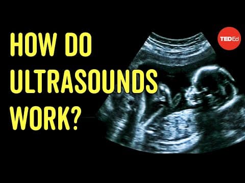 How to see with sound - Jacques S. Abramowicz thumbnail