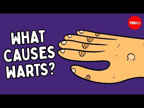 What are warts — and how do you get rid of them? - Cella Wright thumbnail