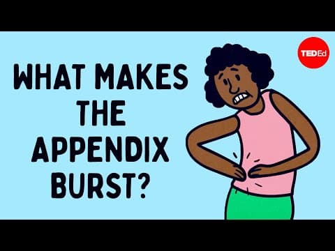 What does appendix pain feel like? - David R. Flum thumbnail