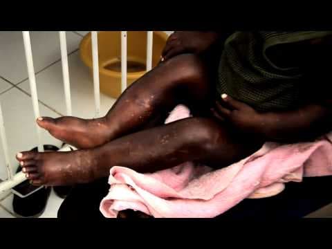 Haiti: Malnutrition thumbnail