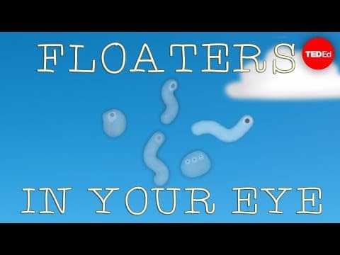 What are those floaty things in your eye? - Michael Mauser thumbnail